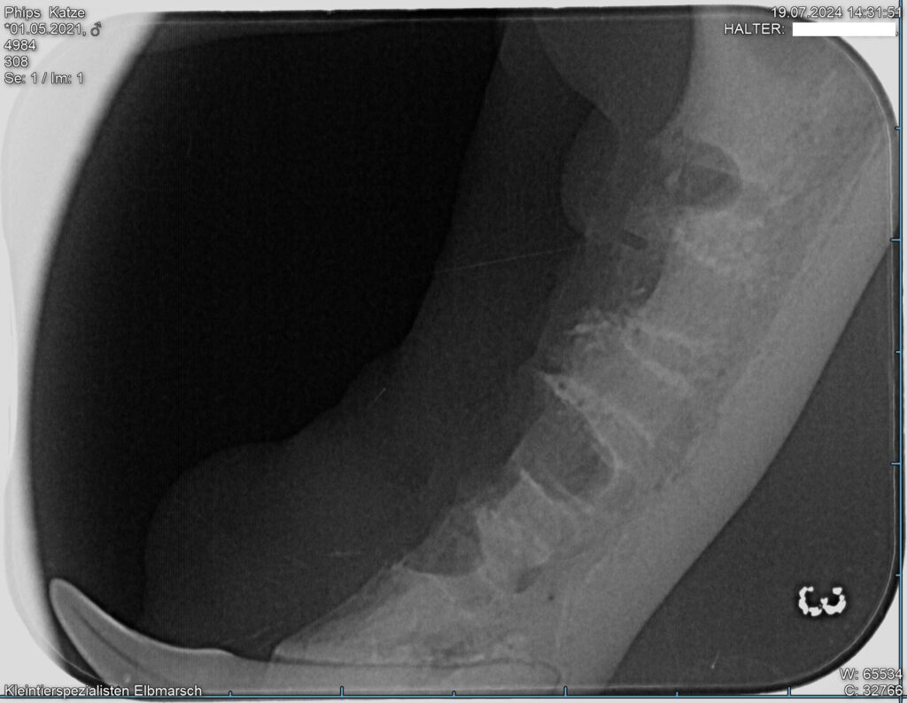 Röntgenbild von anderen Seite des Unterkiefers. Hier fehlen alle Zähne und es ist erkennbar, dass die Wurzeln noch drin sind